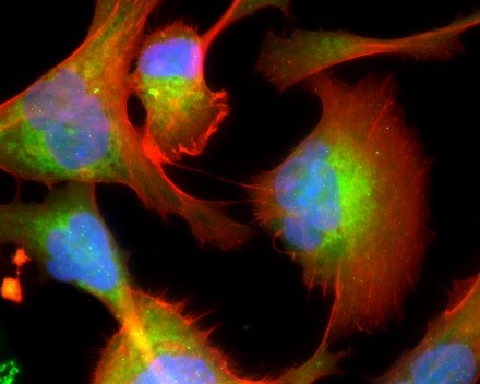 The melanoma microenvironment